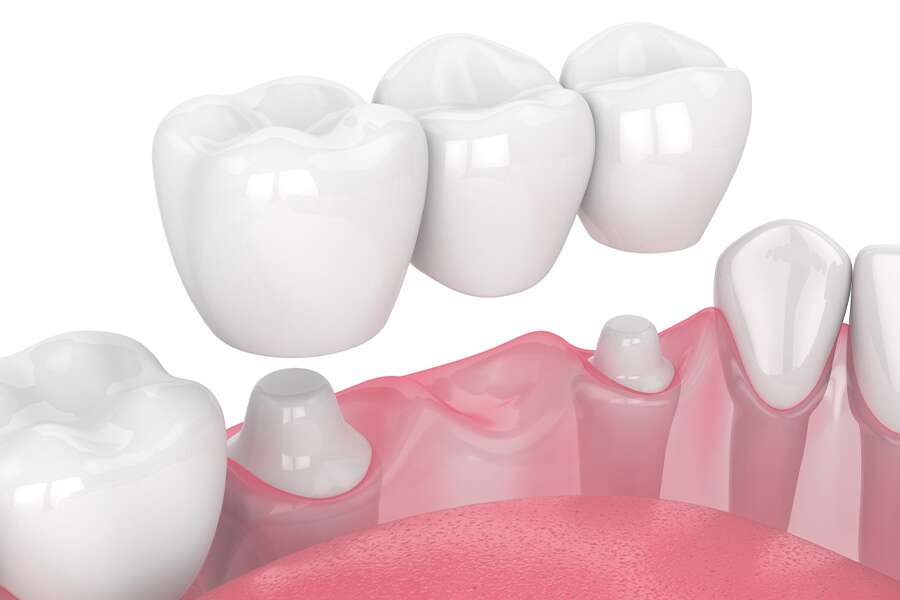 Ura më e mirë dentare në Shqipëri