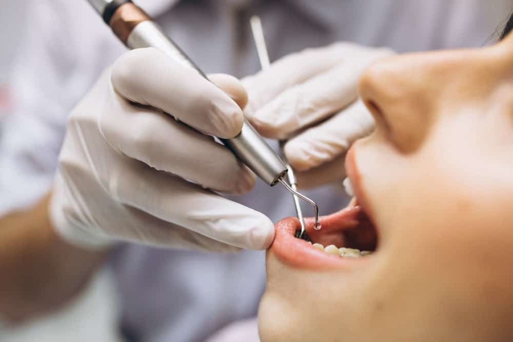 The Importance of Regular Dental Check-Ups at a dentist in Albania