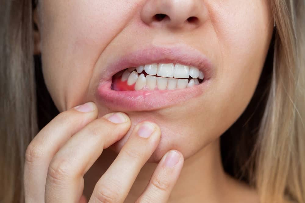 Image illustrating gum disease treatment by a dentist in Albania
