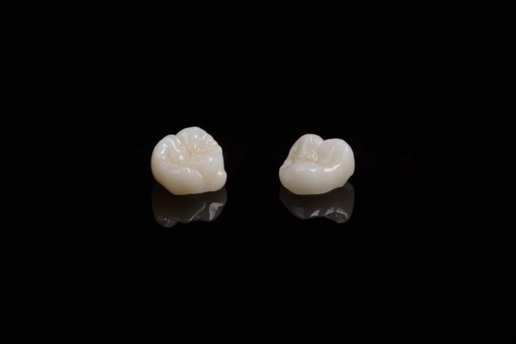 Corone in zirconia di alta qualità e a prezzi accessibili in Albania