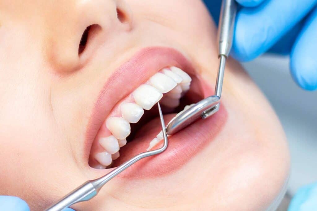 Dental filling procedure.