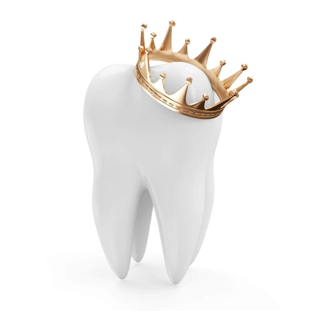 Image illustrating dental crowns in Albania