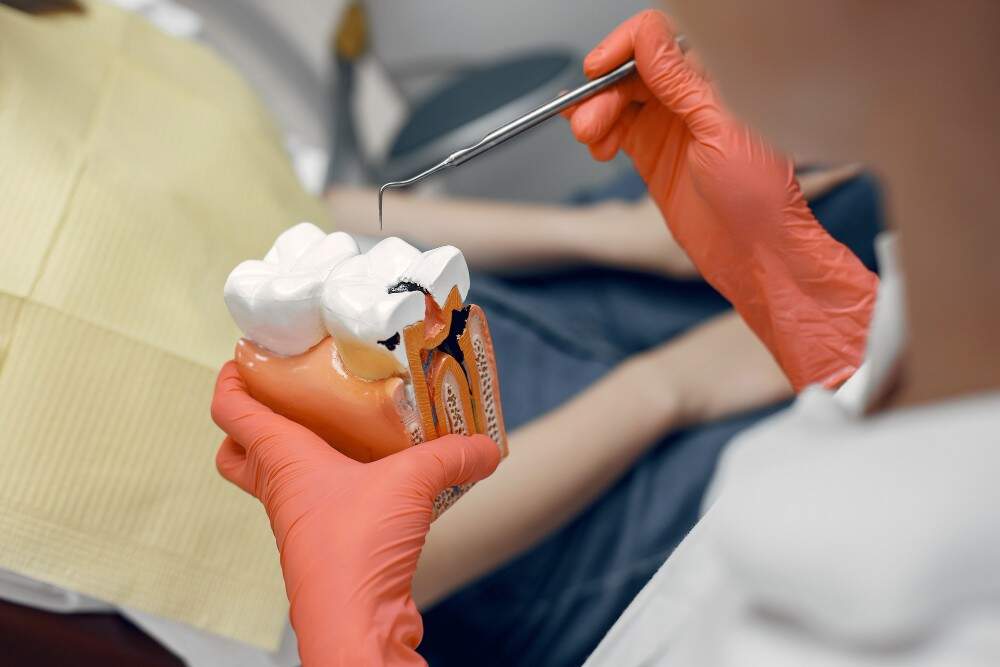 Image illustrating dental erosion.