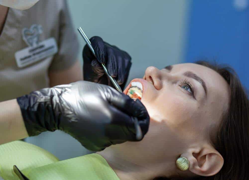 Image illustrating a dental filling procedure in Albania.