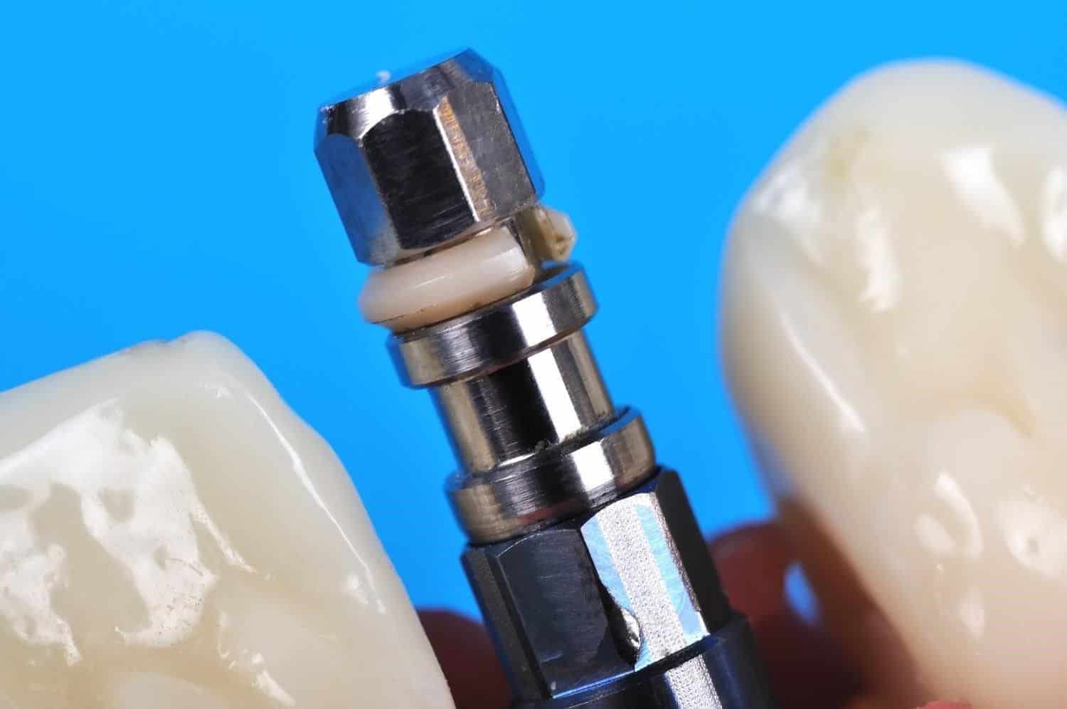 The Most Common Dental Problems and How to Prevent Them