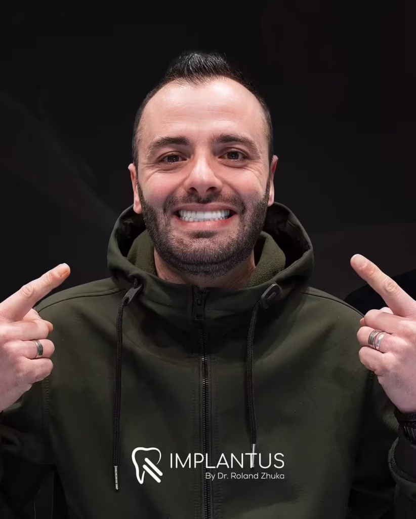 Dental Implant Smile Transformation – Male Patient Albania Dental Clinic_converted