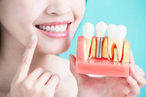 Person holding jaw model showing dental implant post, crown, and natural teeth