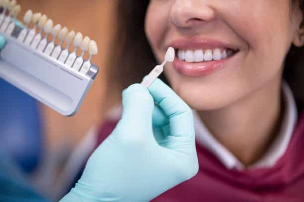 Dentist compares tooth shade guide to patient’s teeth during cosmetic dentistry consultation