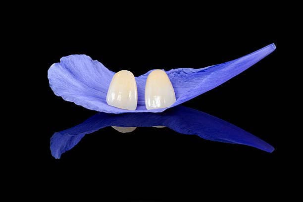 Two ceramic dental veneers on a purple petal with glossy black reflection.