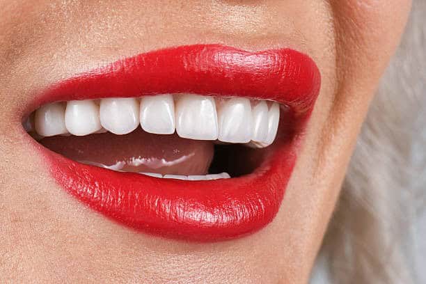 Close-up smile with red lipstick showing straight, white teeth
