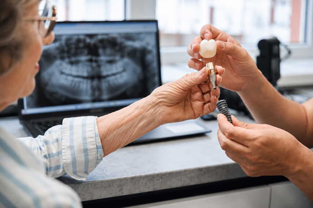 Dentist showing senior patient a dental implant model beside jaw X‑ray on laptop during consultation.