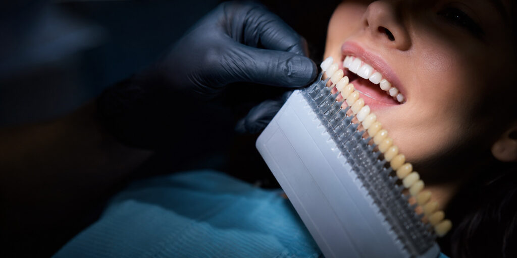 Dentisti me doreza të zeza duke përputhur udhëzuesin e nuancave të dhëmbëve me buzëqeshjen e pacientit për faseta ose kurora.