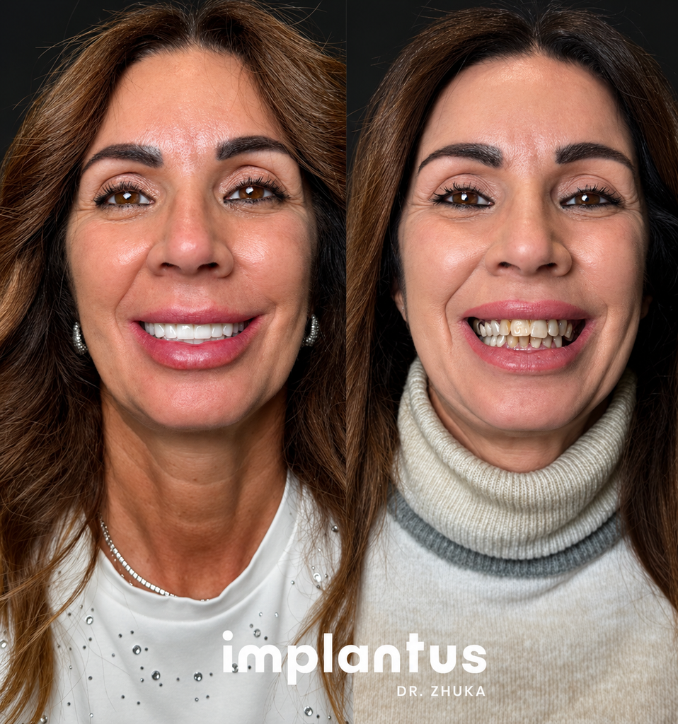 Before-and-after smile comparison; right shows stained, uneven teeth, left bright even cosmetic dentistry result.