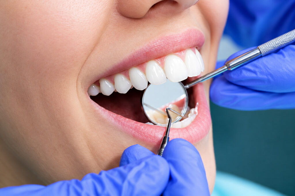 Dentist examining patient's teeth with mirror and dental tools.