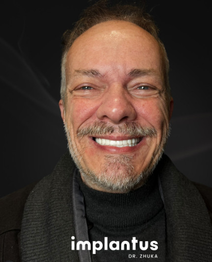 Portrait rapproché d’un homme souriant avec des implants dentaires, pour des soins dentaires en Albanie.